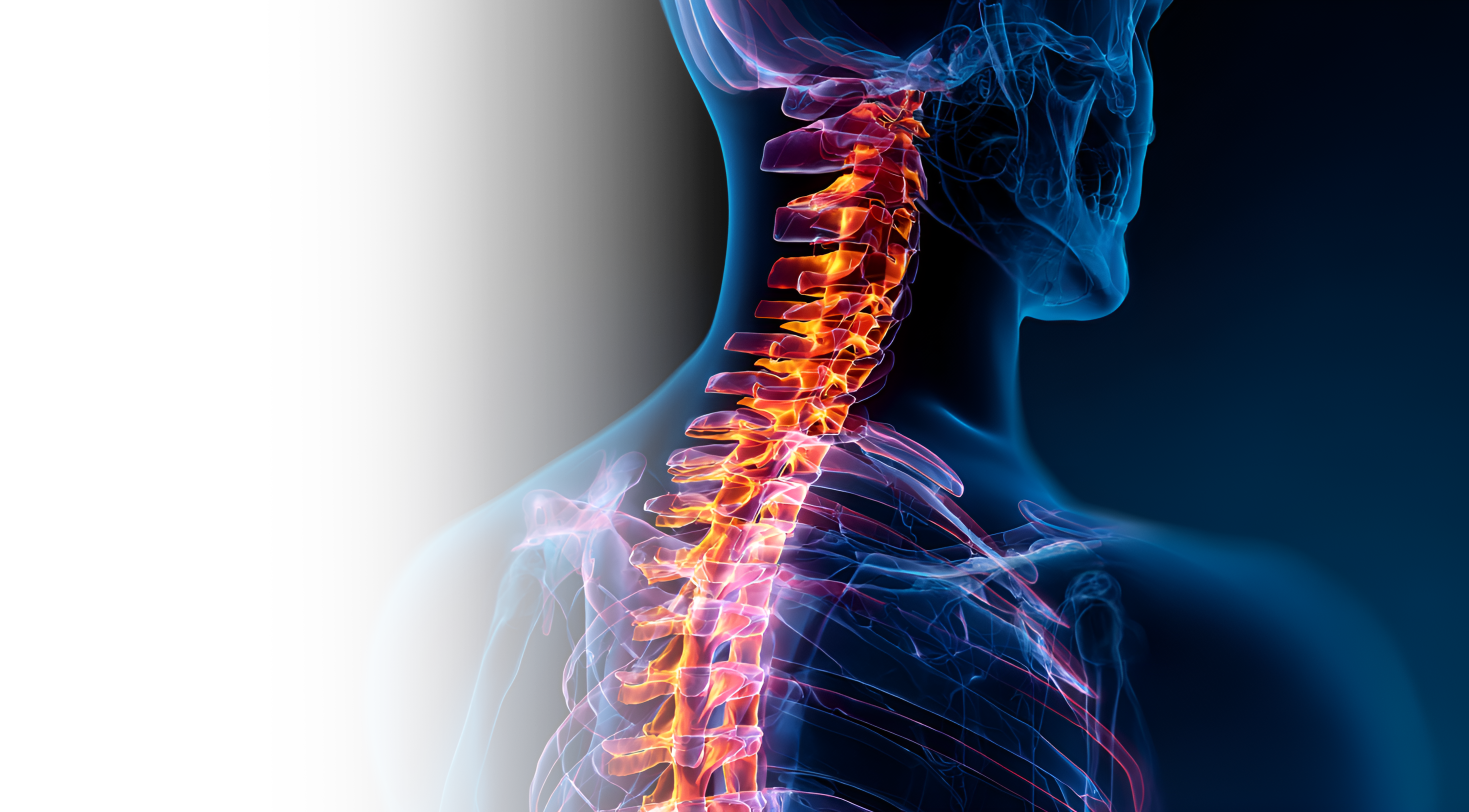 Стабилизация позвоночника на грудном отделе