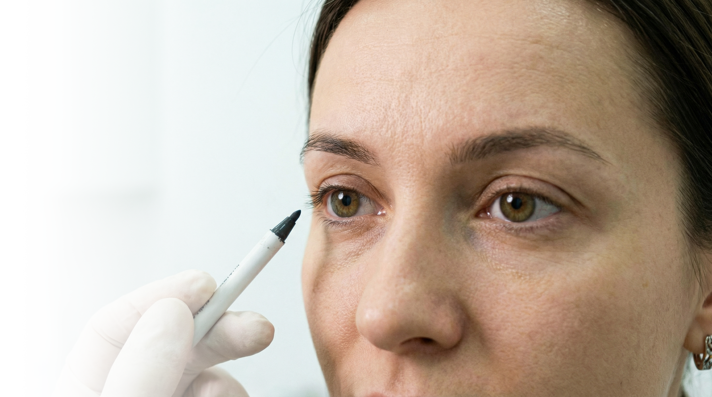 Пластика глаз