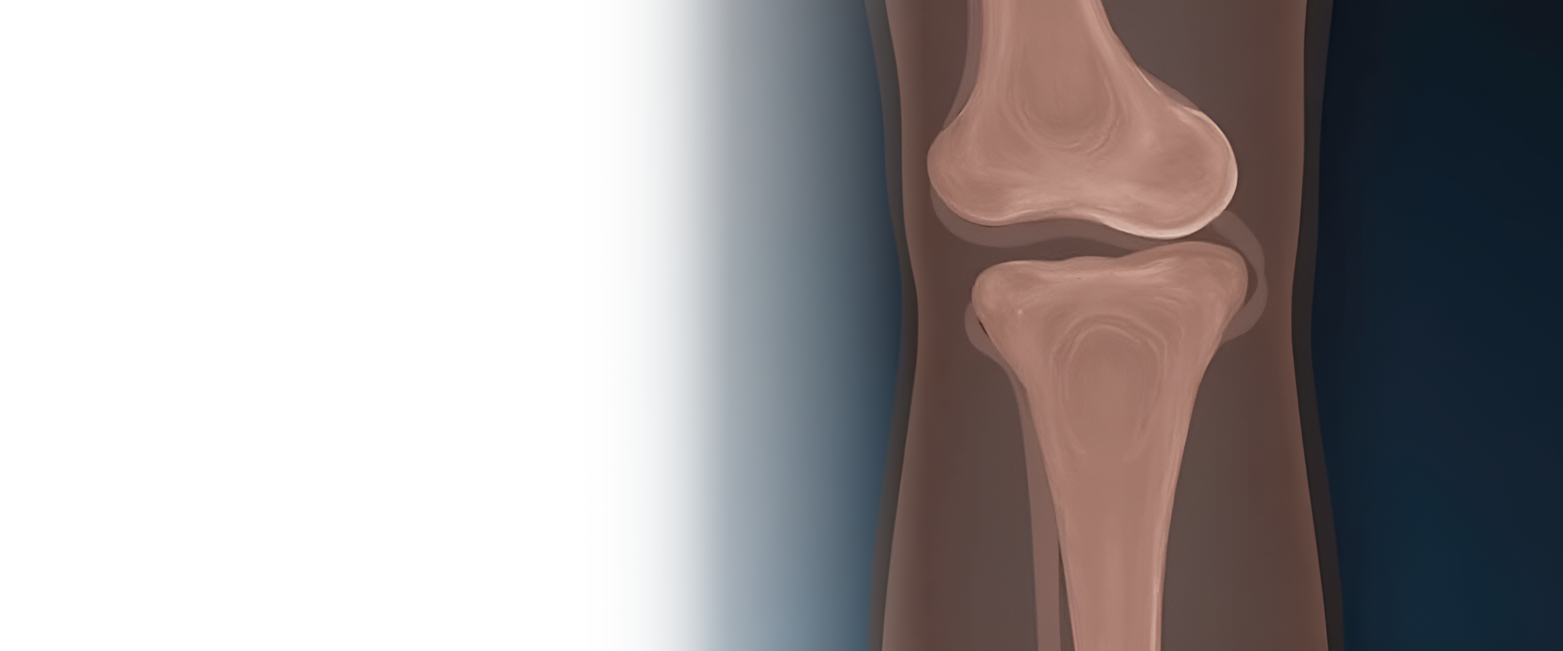 Артроскопия суставов