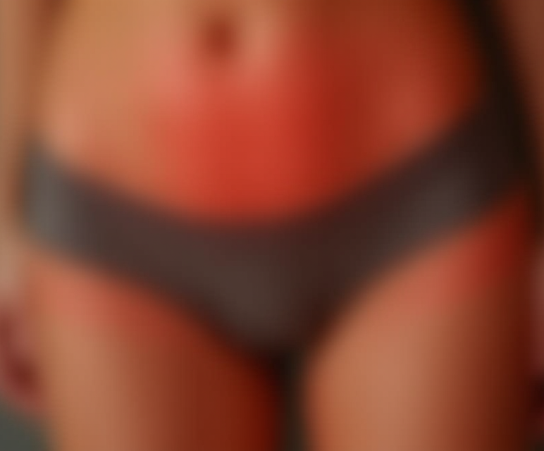 Вылущивание кисты бартолиновой железы