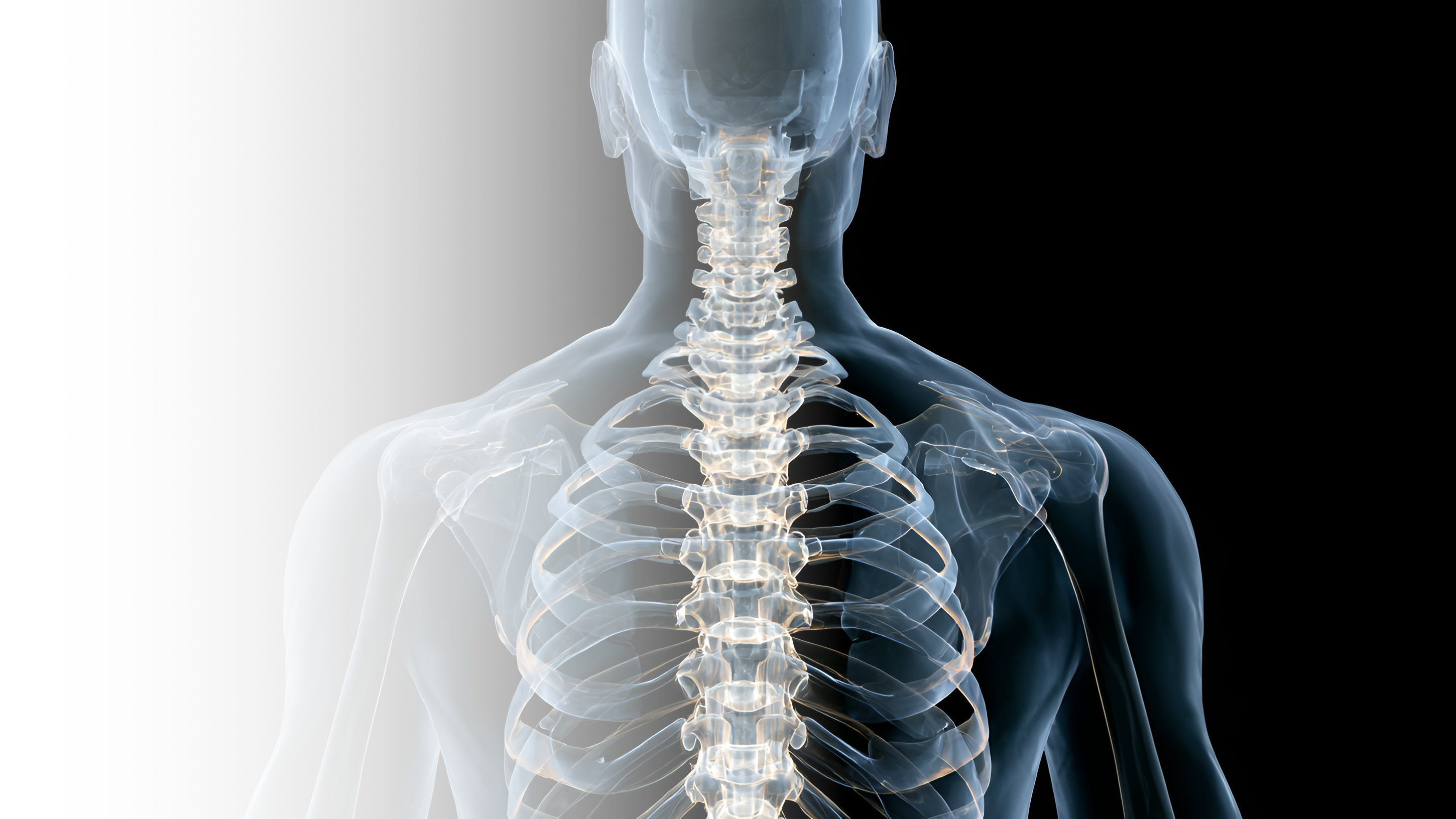 Грудная ламинэктомия