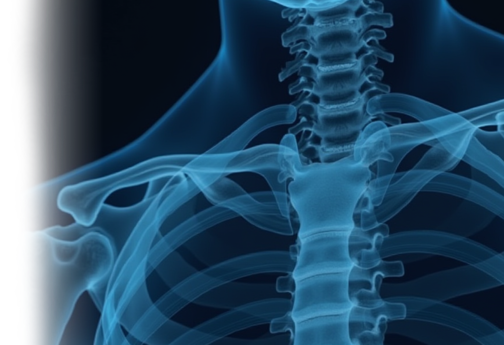 КТ костной структуры