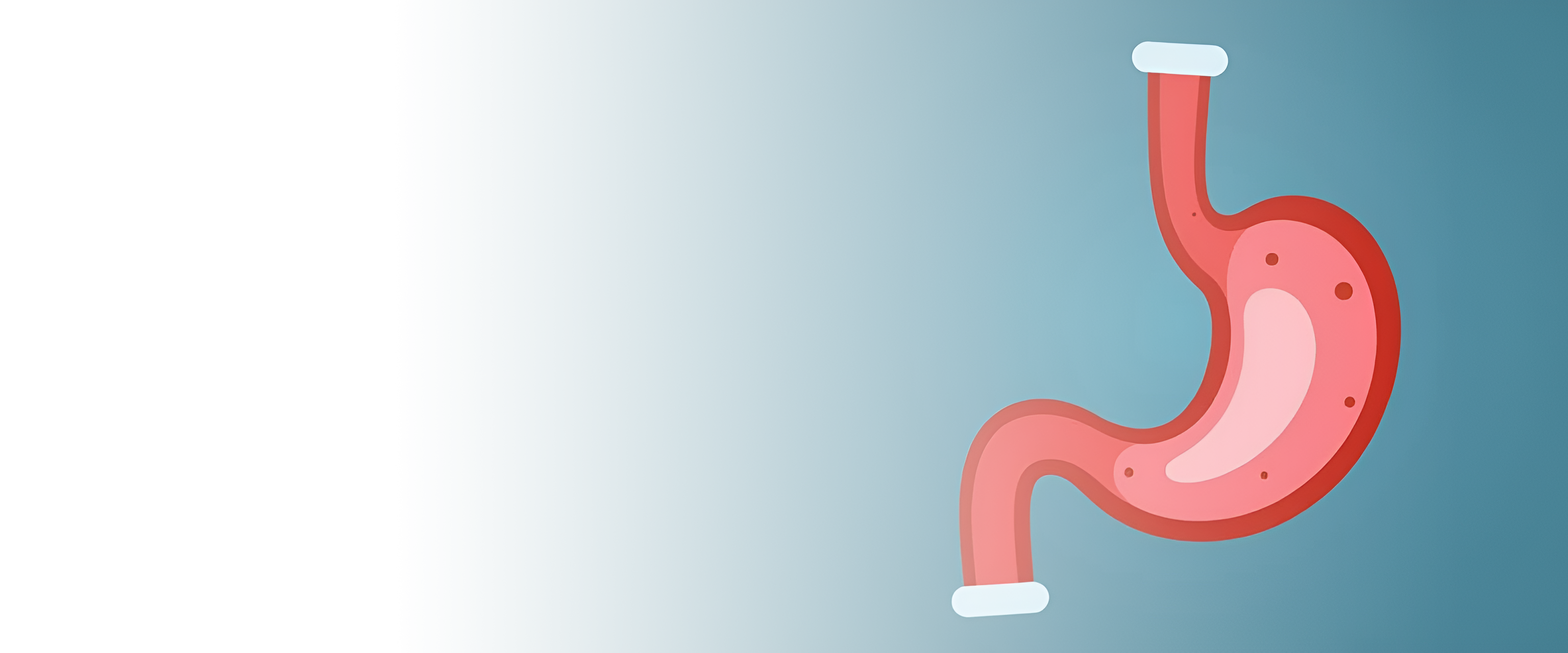 Фундопликация