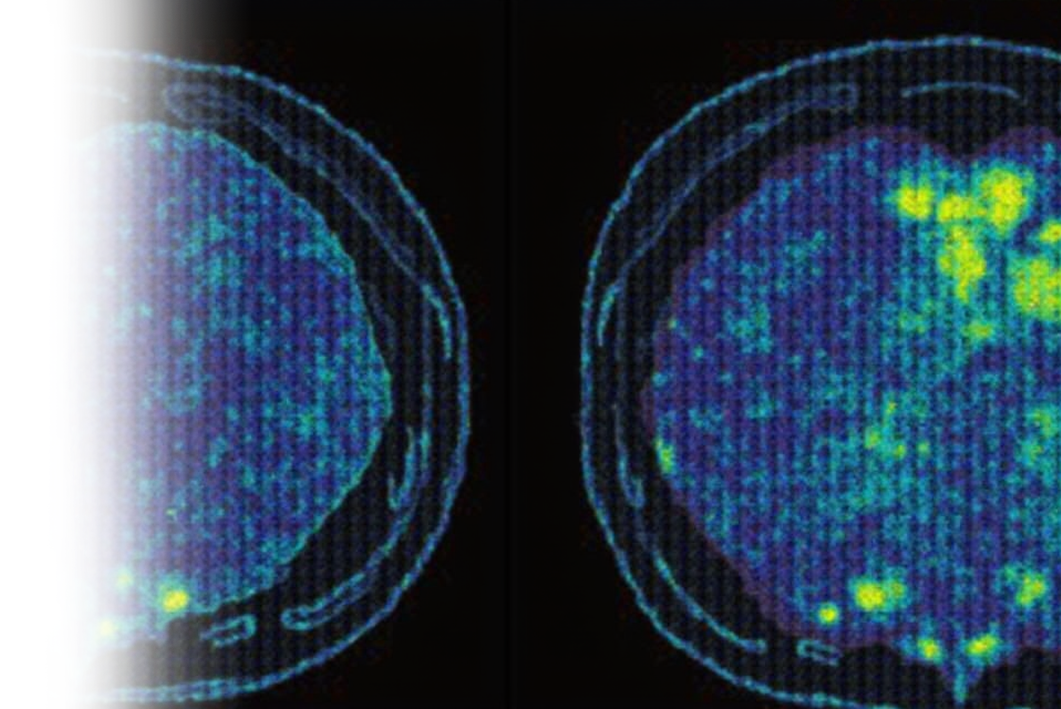 КТ мягких тканей с контрастированием