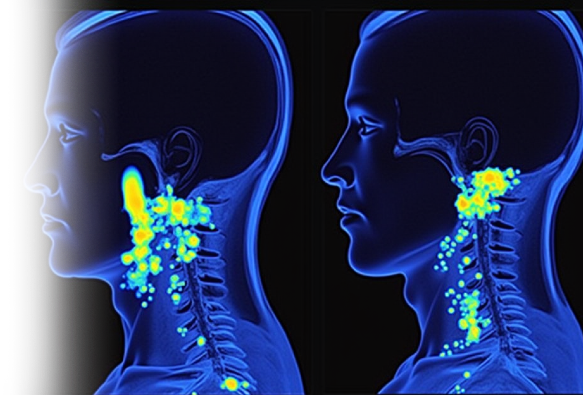 КТ мягких тканей шеи с контрастированием