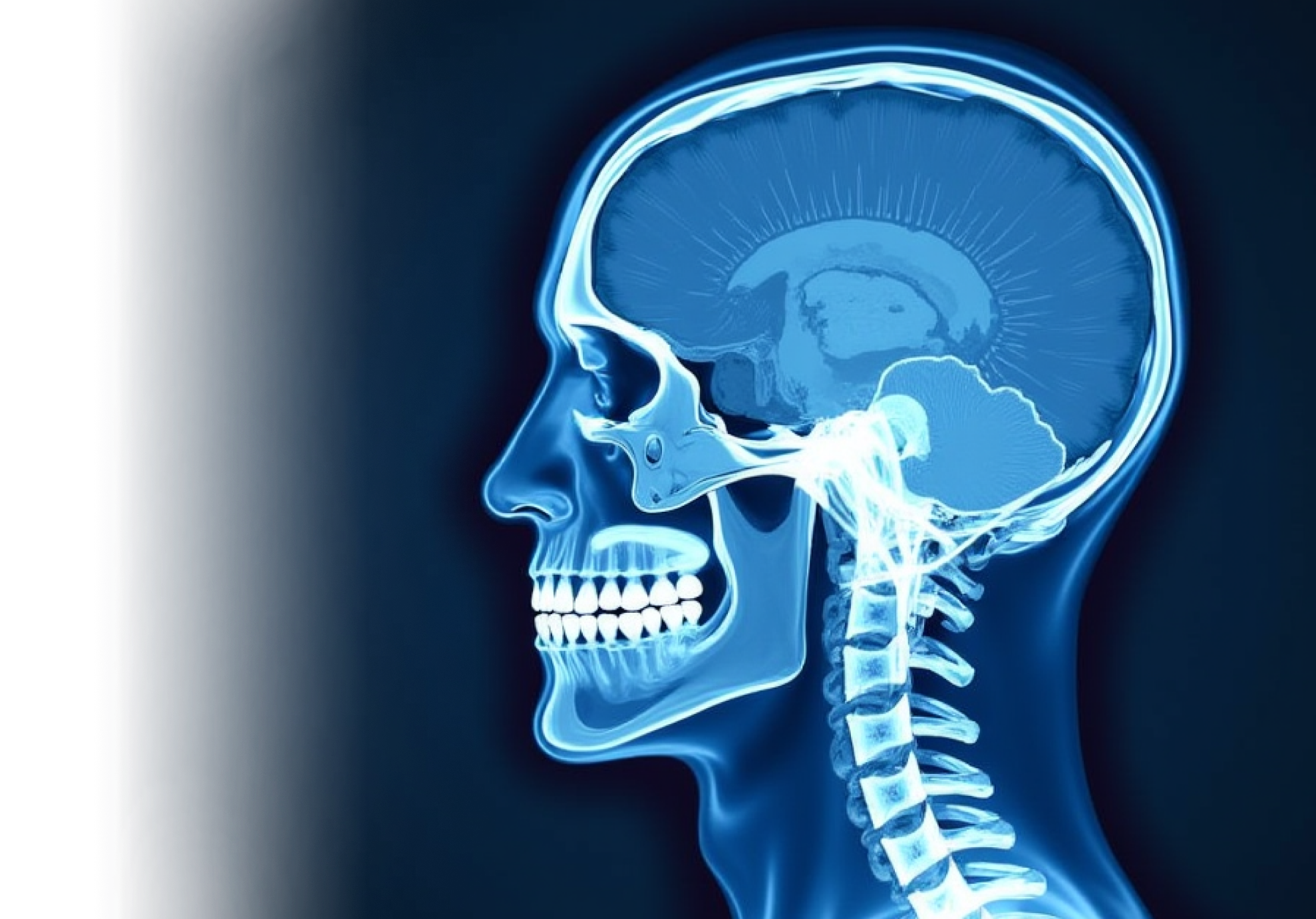 КТ головного мозга с контрастированием