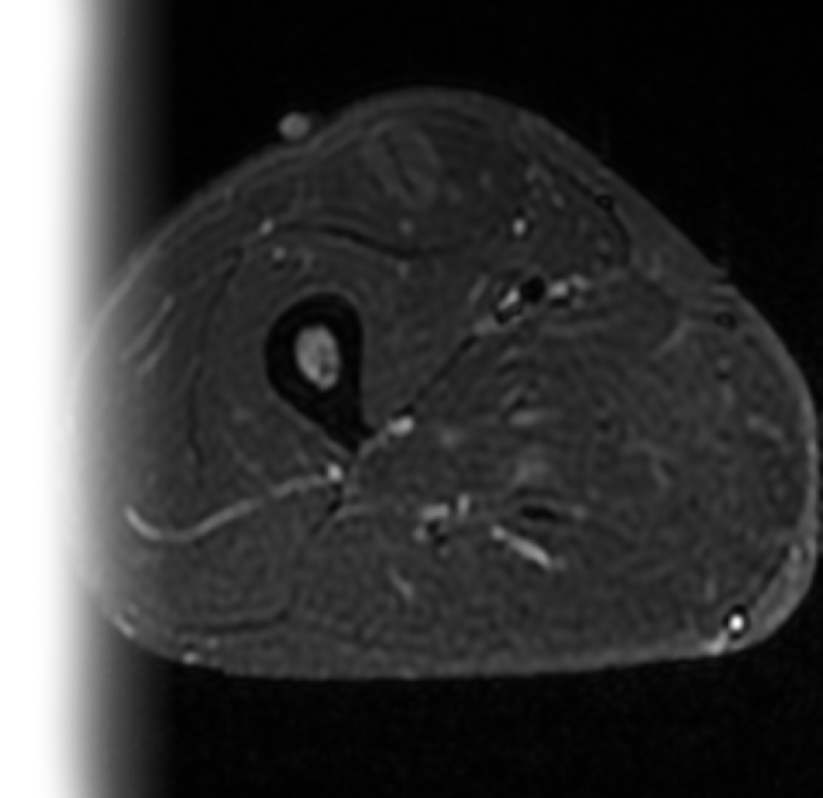 МРТ мягких тканей