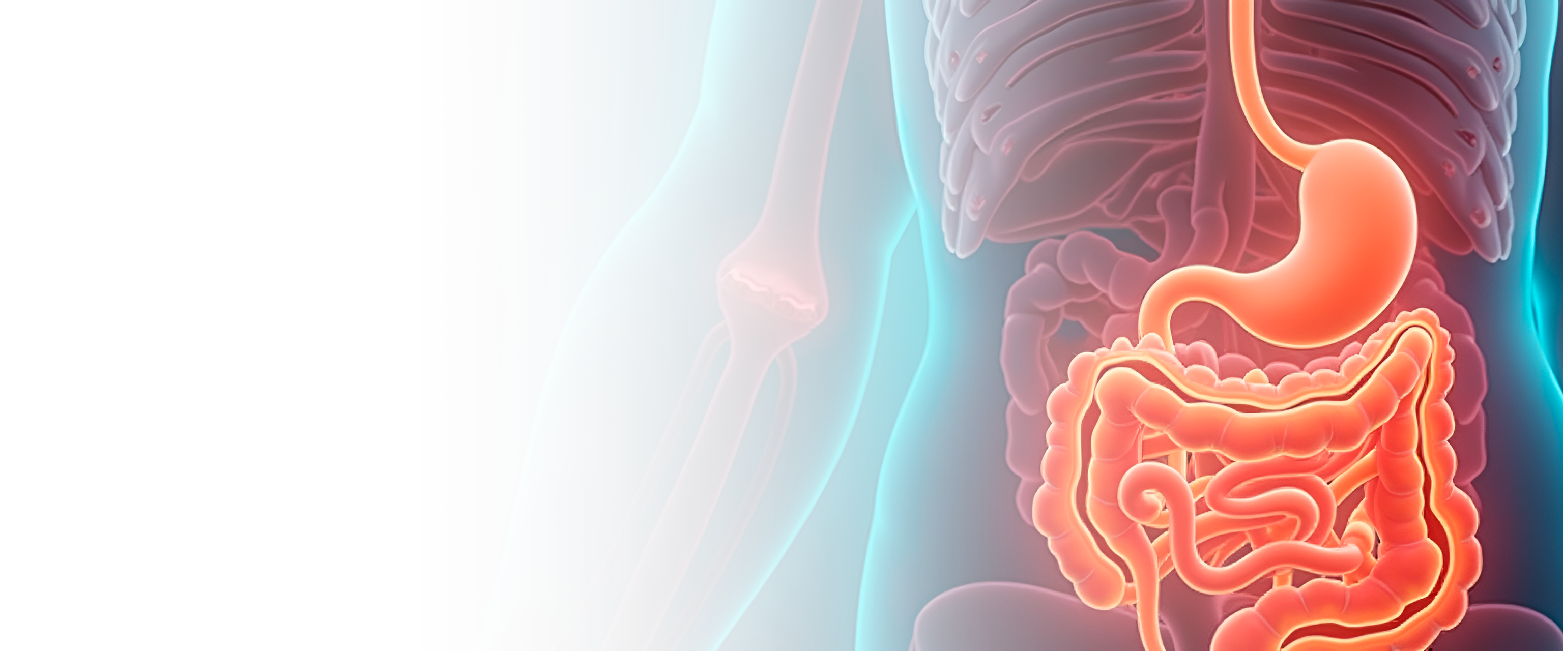 Колостомия