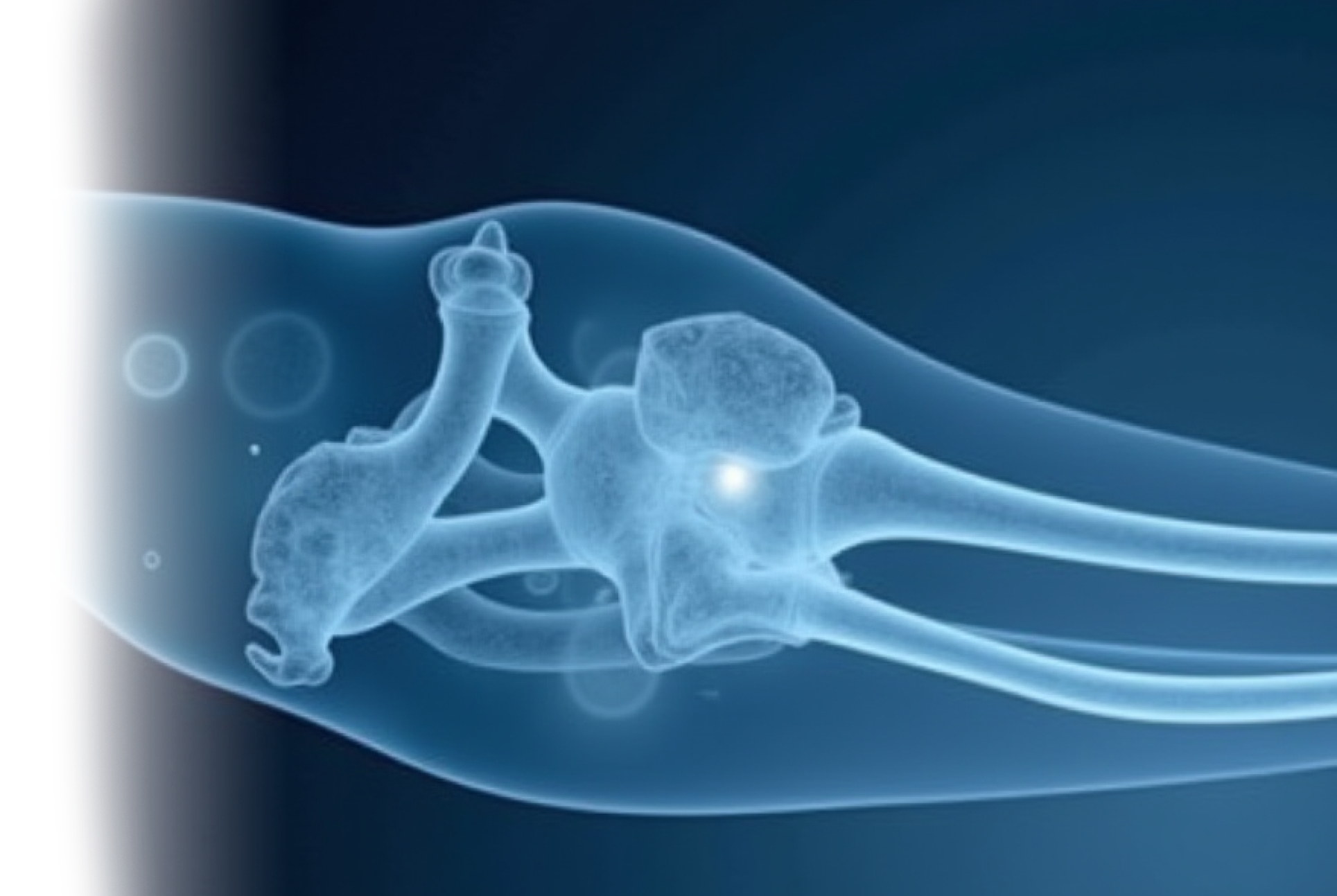 КТ сегмента конечности