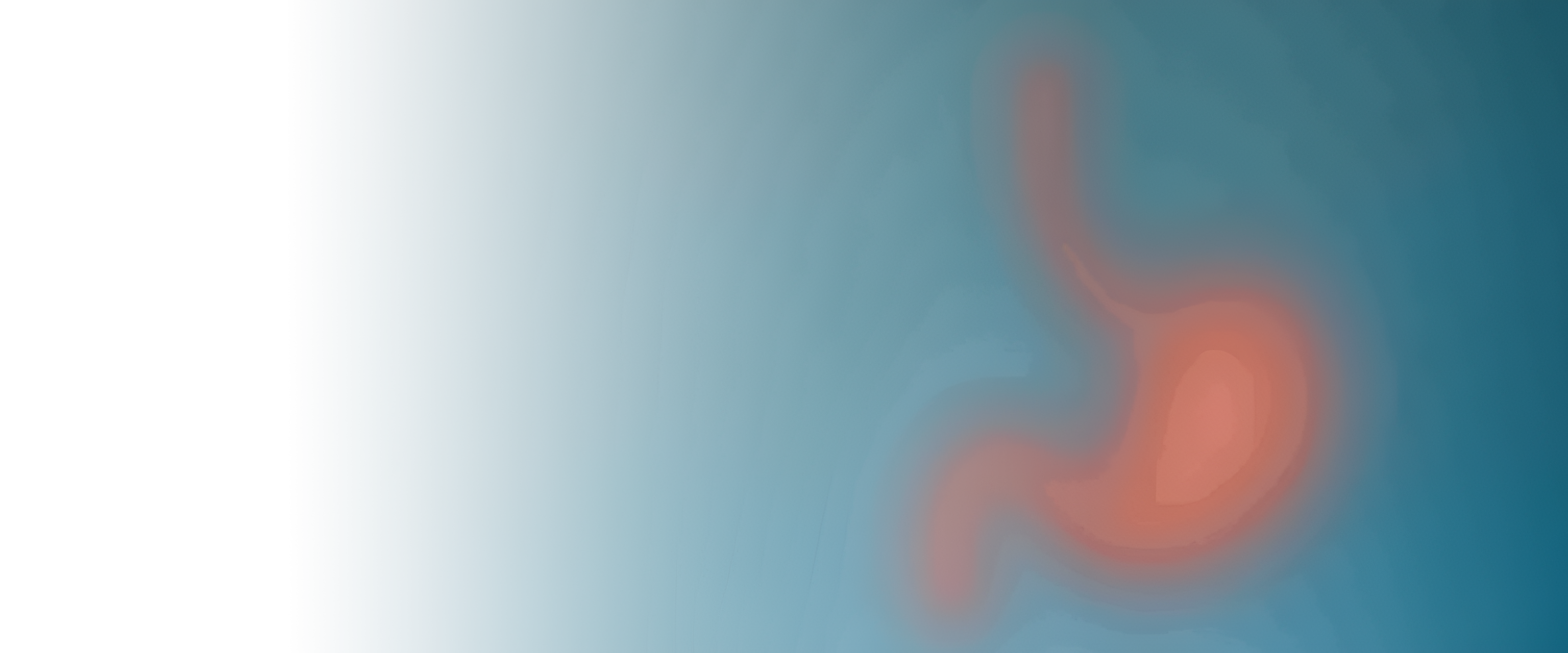 Гастрэктомия