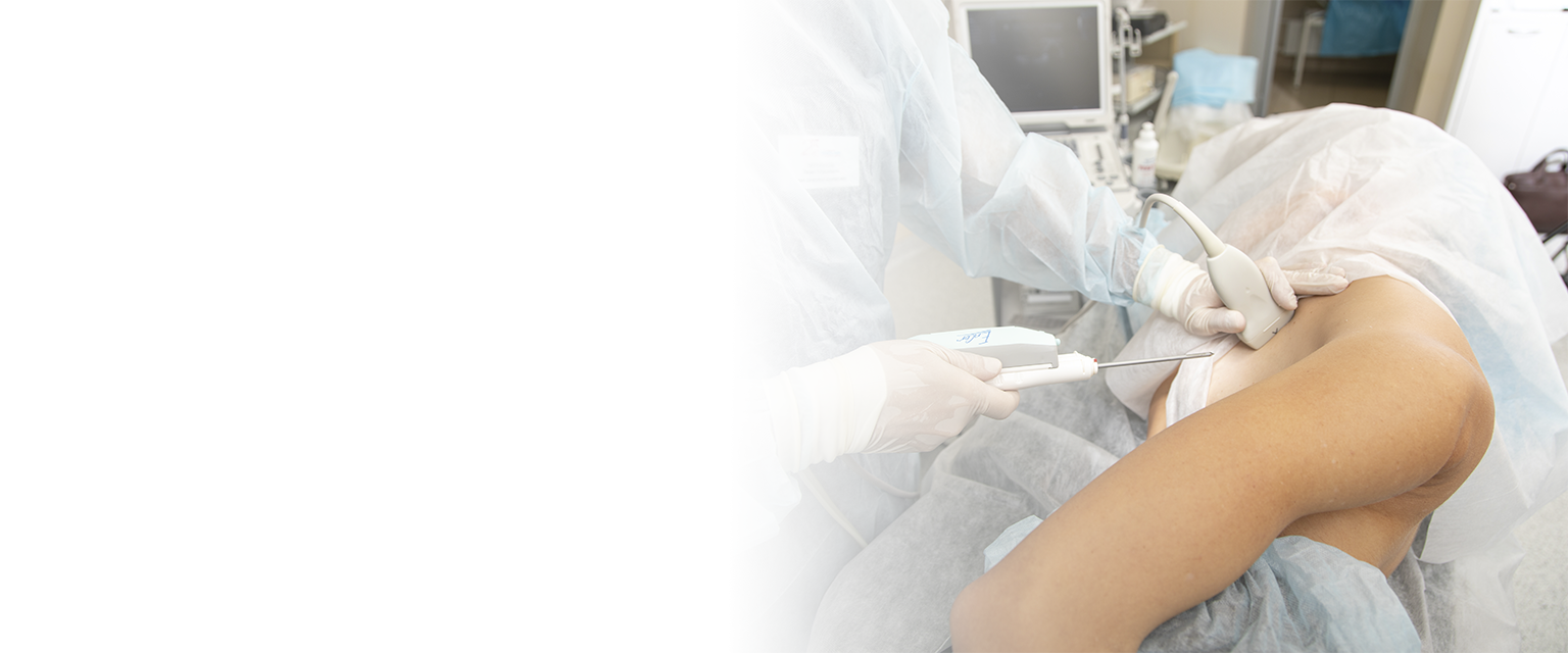 Вакуумная аспирационная биопсия (лечение узловых образований)