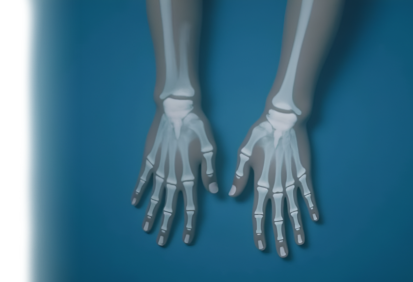 Кожная пластика кисти