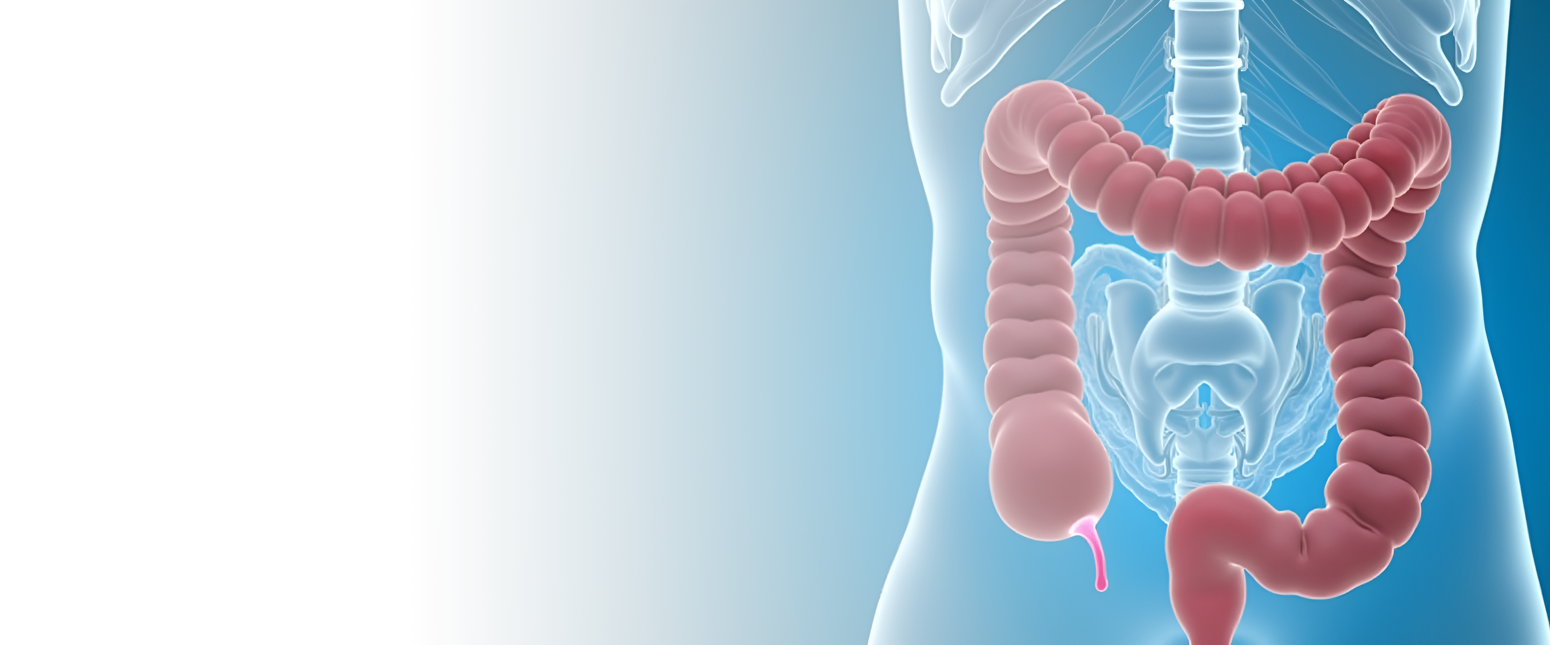 Илеостомия