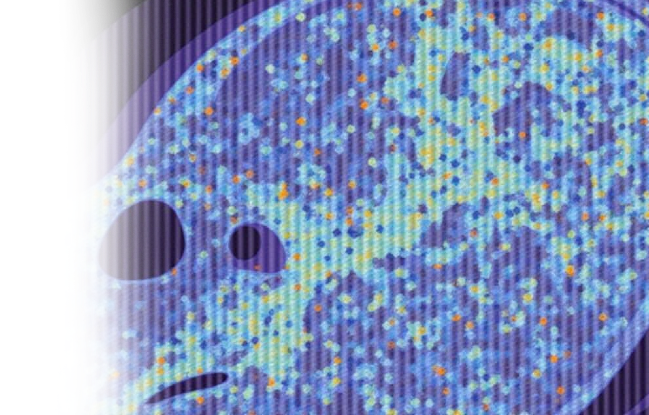 КТ мягких тканей шеи с фонацией