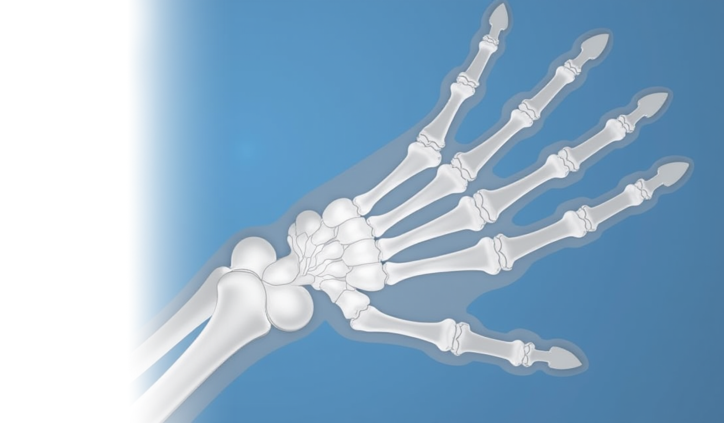 Операции при костных травмах кисти и их последствиях