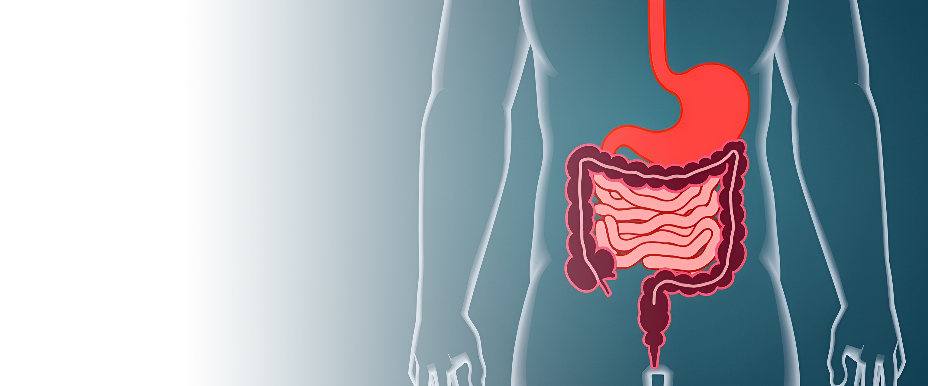 Иссечение дивертикула тонкого кишечника