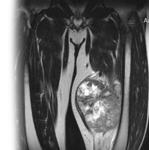 МРТ мягких тканей с контрастом