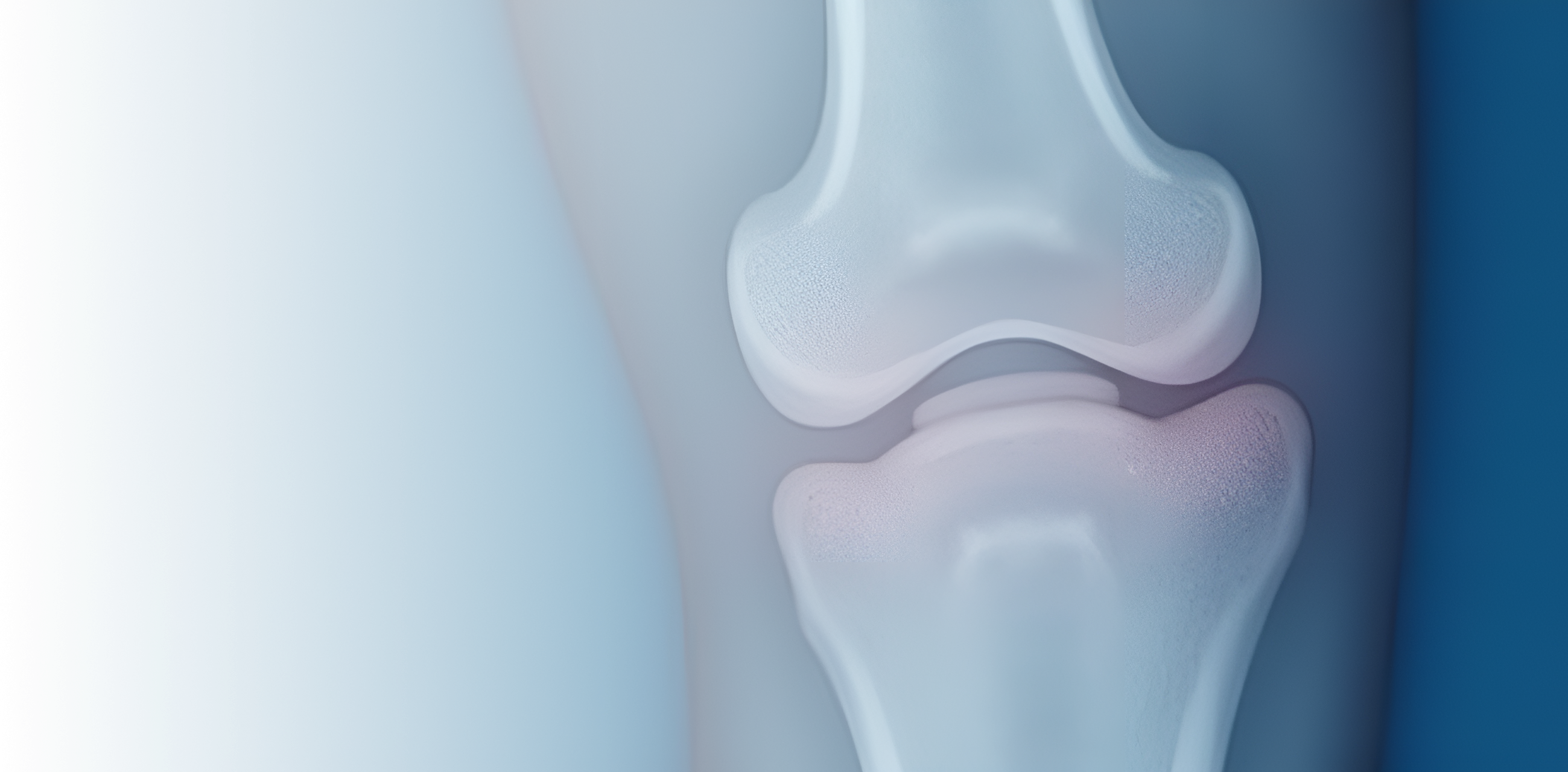 Остэктомия