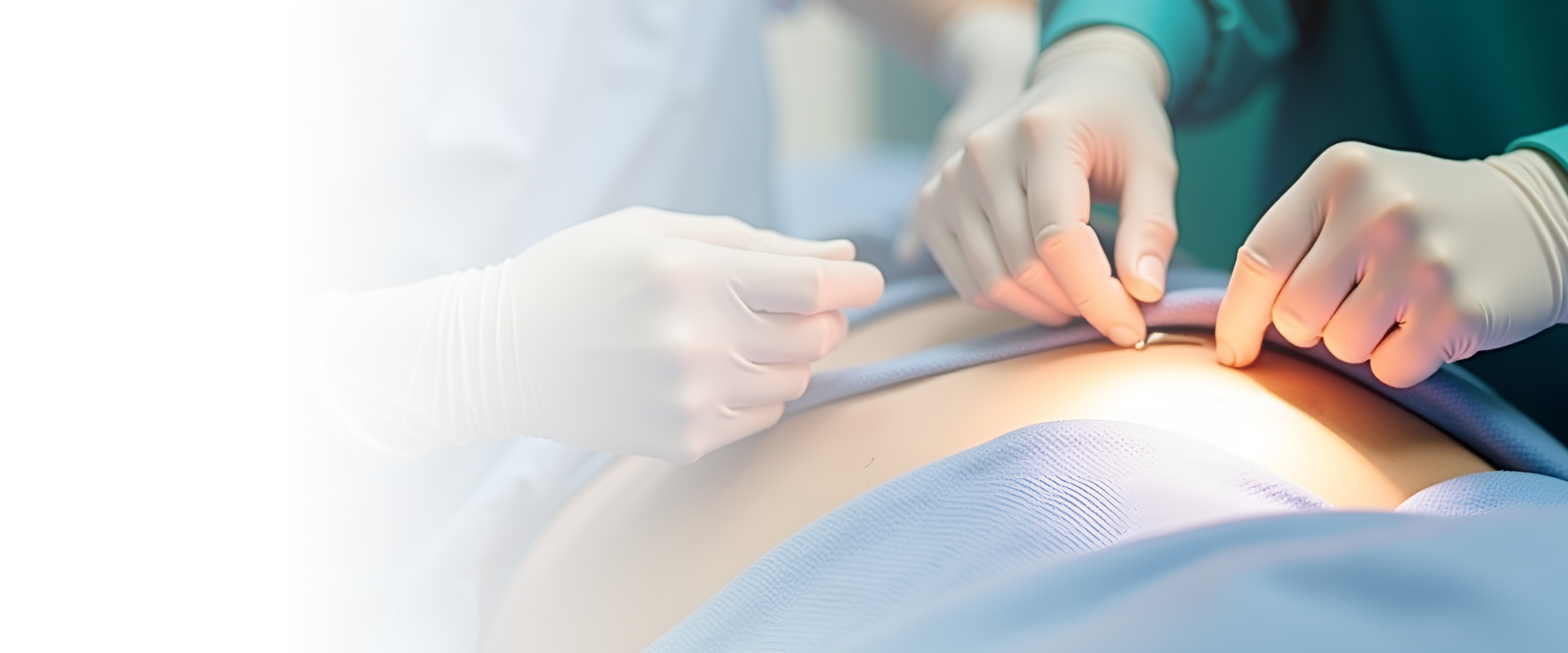 Дистальная резекция поджелудочной железы