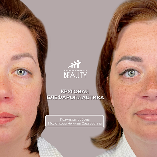 Примеры работ пластического хирурга Молоткова Н.С.