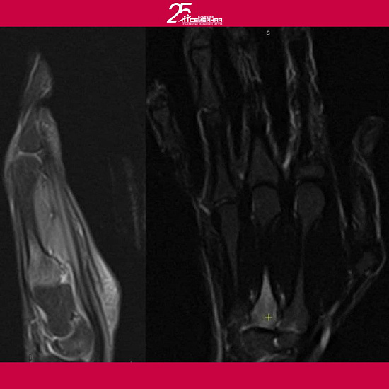 Все валится из рук