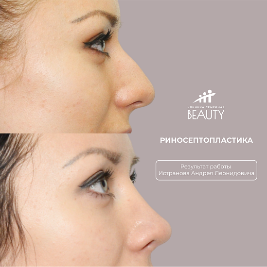 Примеры работ пластического хирурга Истранова А.Л.