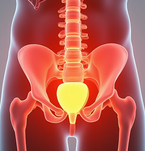 Удаление камней мочевого пузыря