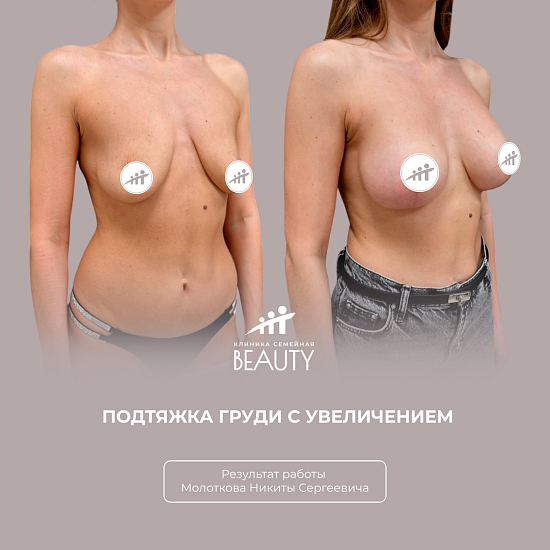 Примеры работ пластического хирурга Молоткова Н.С.