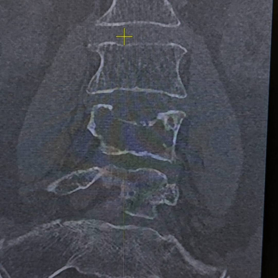 Что скрывают боли в пояснице?