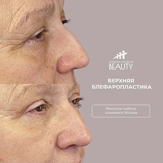 Примеры работ пластического хирурга Альхамати Ж.В.