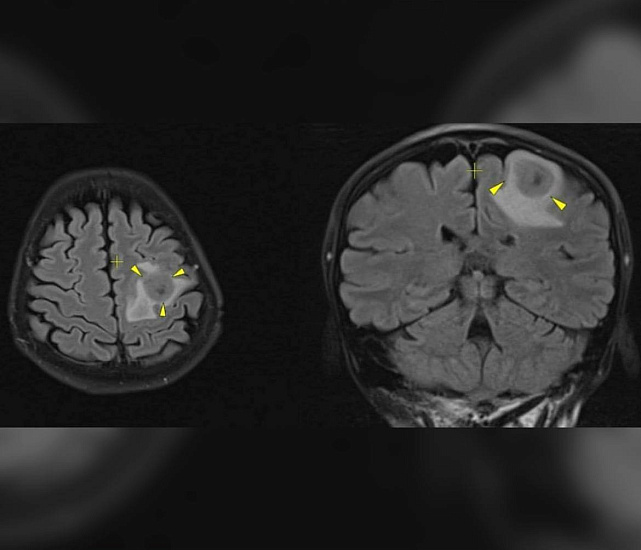 Болит спина