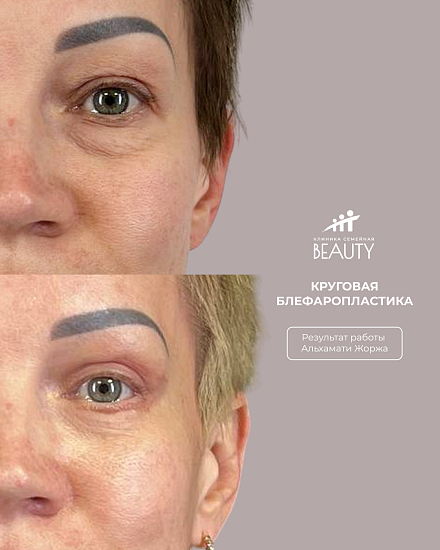 Примеры работ пластического хирурга Альхамати Ж.В.