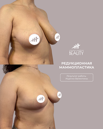 Примеры работ пластического хирурга Ищенко В.И.