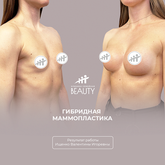 Примеры работ пластического хирурга Ищенко В.И.