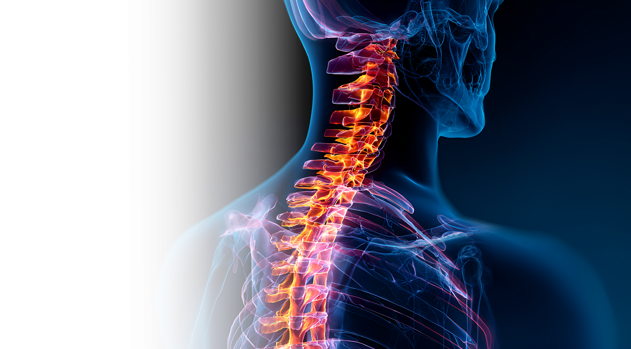 Стабилизация позвоночника на грудном отделе