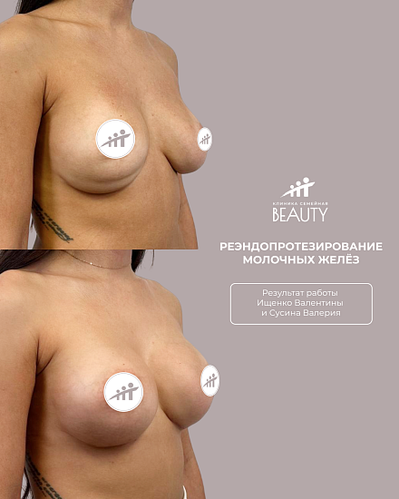 Примеры работ пластического хирурга Ищенко В.И.