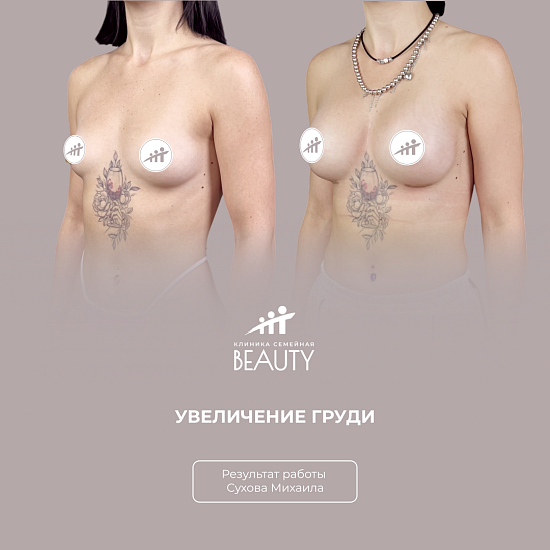 Примеры работ пластического хирурга Сухова М.Н.