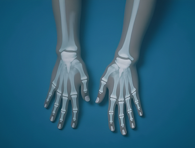 Кожная пластика кисти