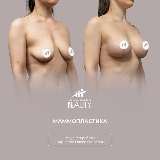 Примеры работ пластического хирурга Старцевой О.И.