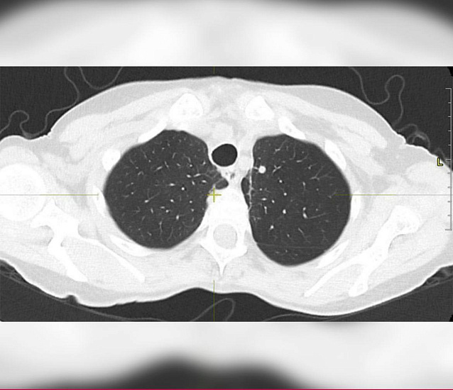 Болит спина