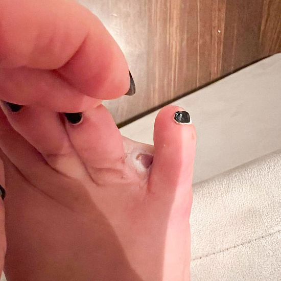 Удар мизинцем о мебель