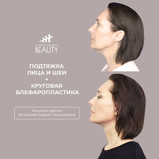 Примеры работ пластического хирурга Истранова А.Л.