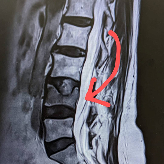 Что скрывают боли в пояснице?