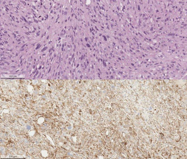 Болит спина