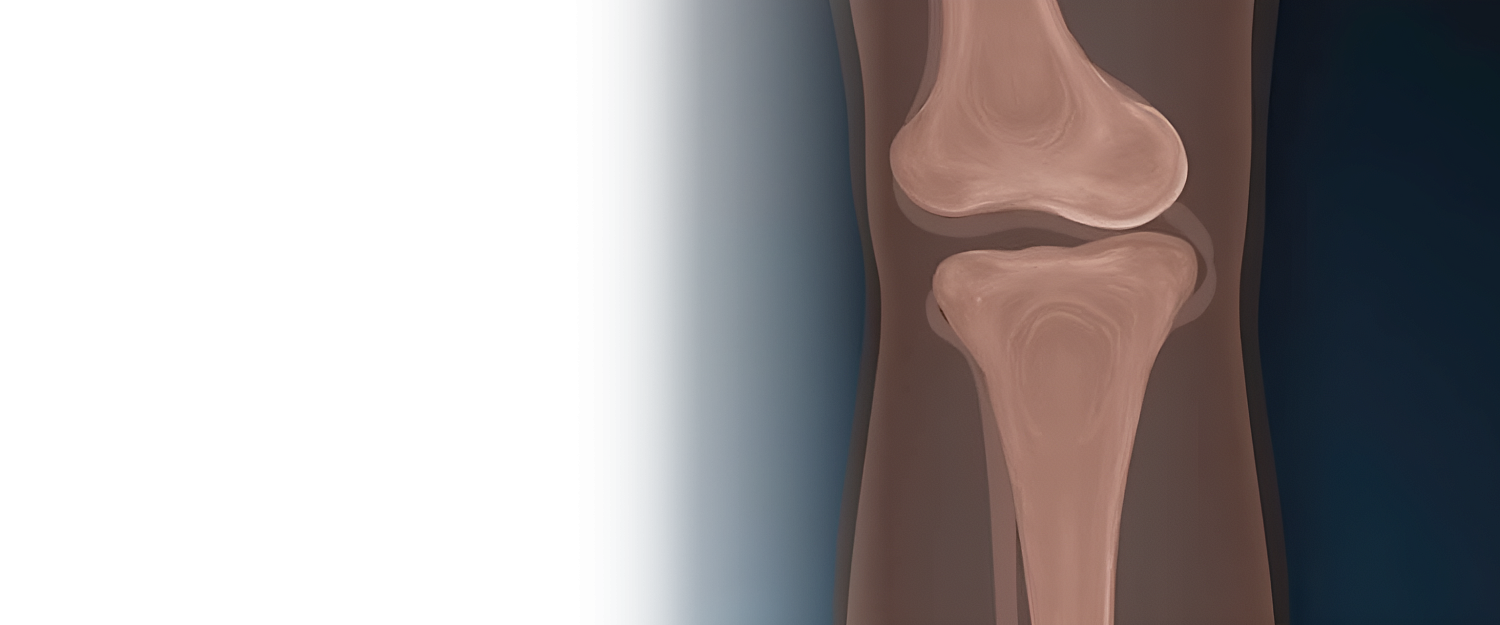 Артроскопия суставов