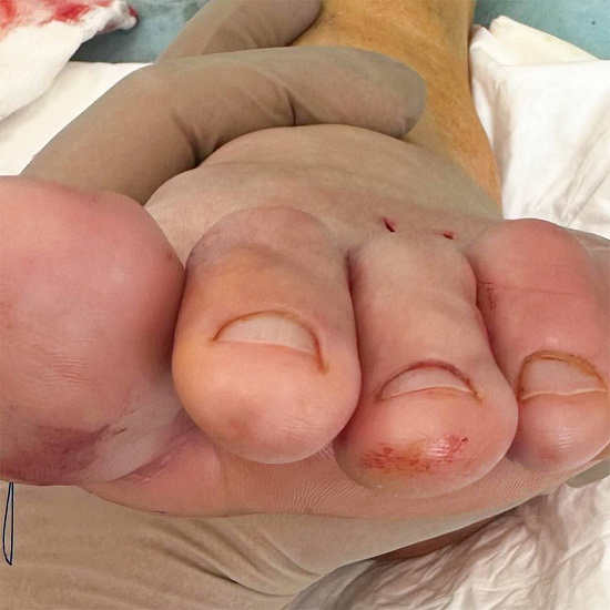 Пучок из пальцев