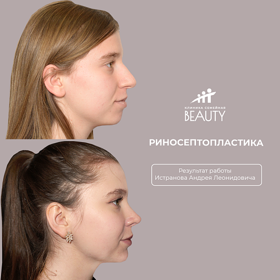 Примеры работ пластического хирурга Истранова А.Л.