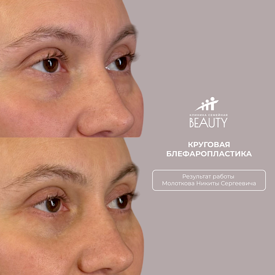 Примеры работ пластического хирурга Молоткова Н.С.