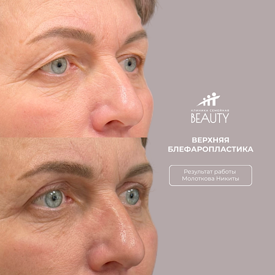 Примеры работ пластического хирурга Молоткова Н.С.