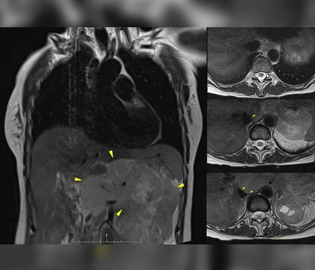 Болит спина